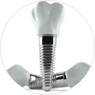 Aesthetical - Dental Implants