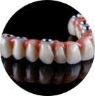 Aesthetical - Hybrid-Prostheses