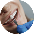 Aesthetical - crowns-veneers