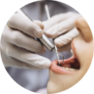 Aesthetical - laser-gingivectomy